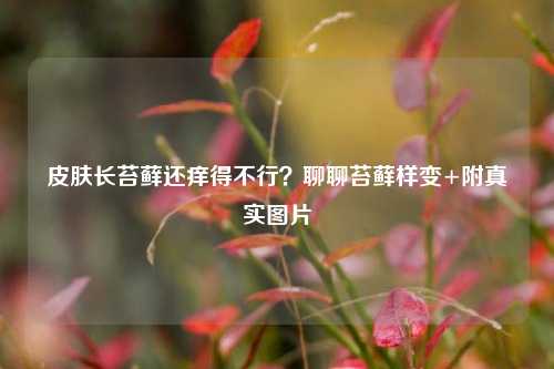 皮肤长苔藓还痒得不行？聊聊苔藓样变+附真实图片