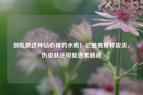 别乱抓这种钻心痒的水疱！它是疱疹样皮炎，伤皮肤还可能连累肠道